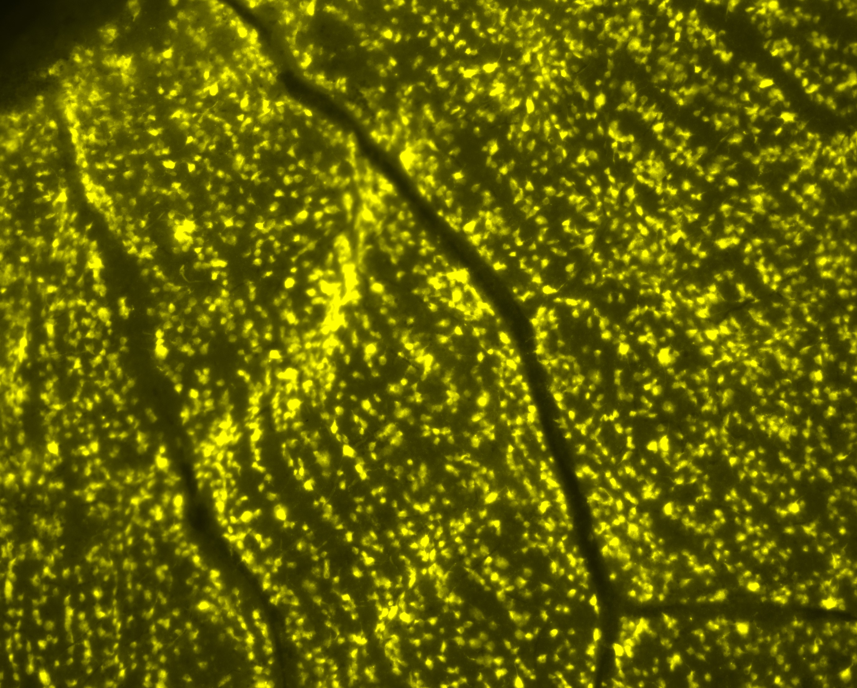 Morphometric analysis Quantification of OCT image